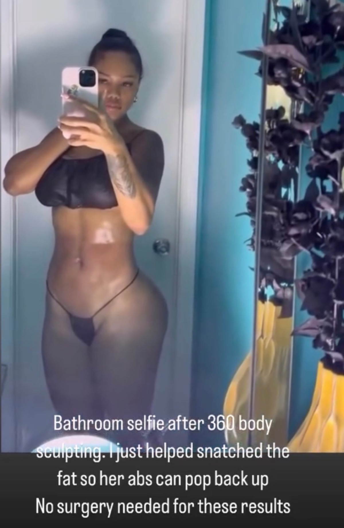Body contouring result 1