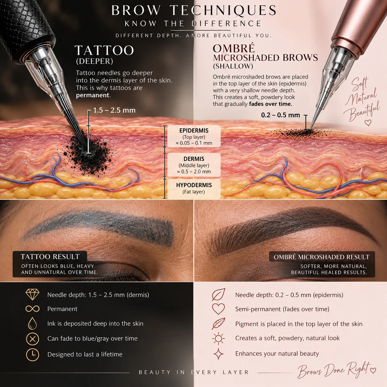 Comparison of tattoo versus ombr&eacute; microshaded brows. A tattoo needle goes 1.5 to 2.5 millimetres deep into the dermis, which is why tattoos are permanent and can fade to blue or grey over time. Ombr&eacute; microshaded brows are placed 0.2 to 0.5 millimetres deep in the epidermis, the top layer of skin, creating a soft powdery look that fades gradually and is semi-permanent.