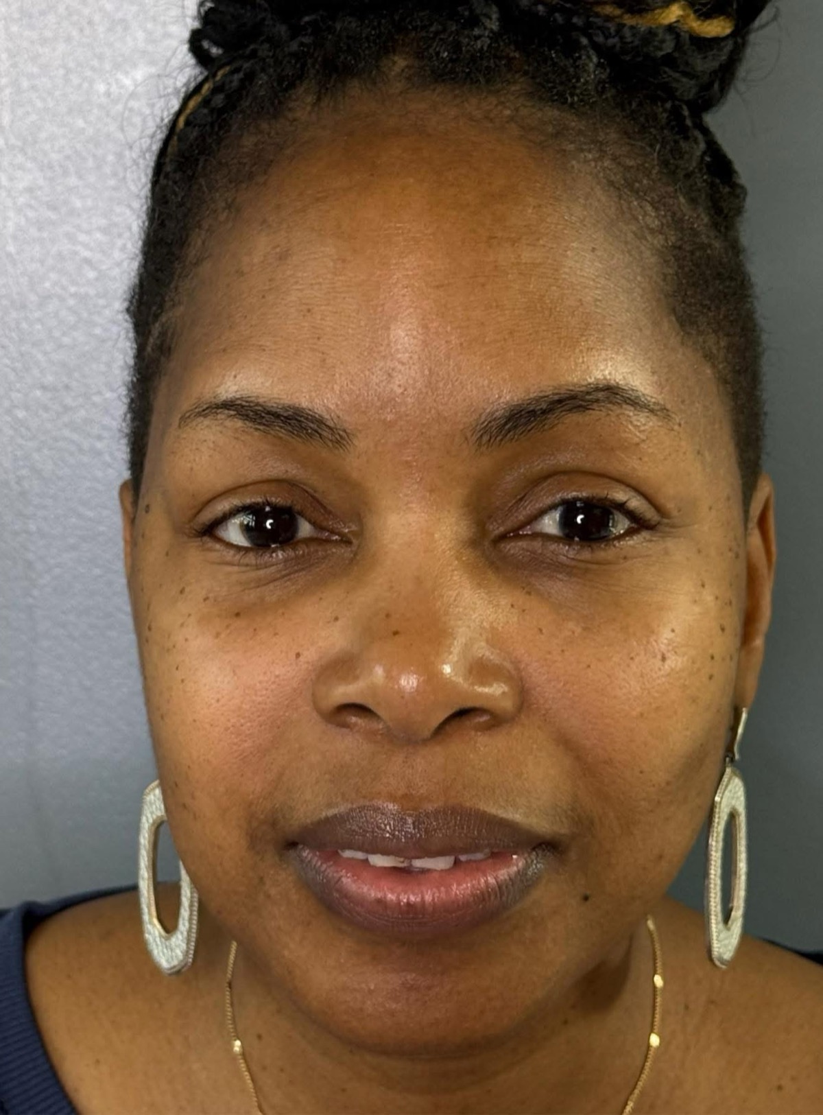 Brows before — pair 2