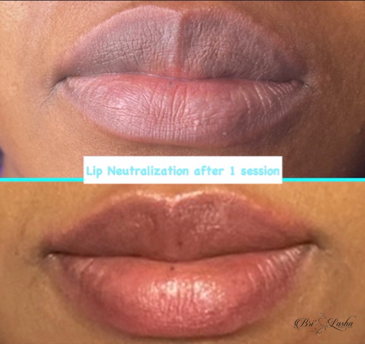 Lip tattoo result